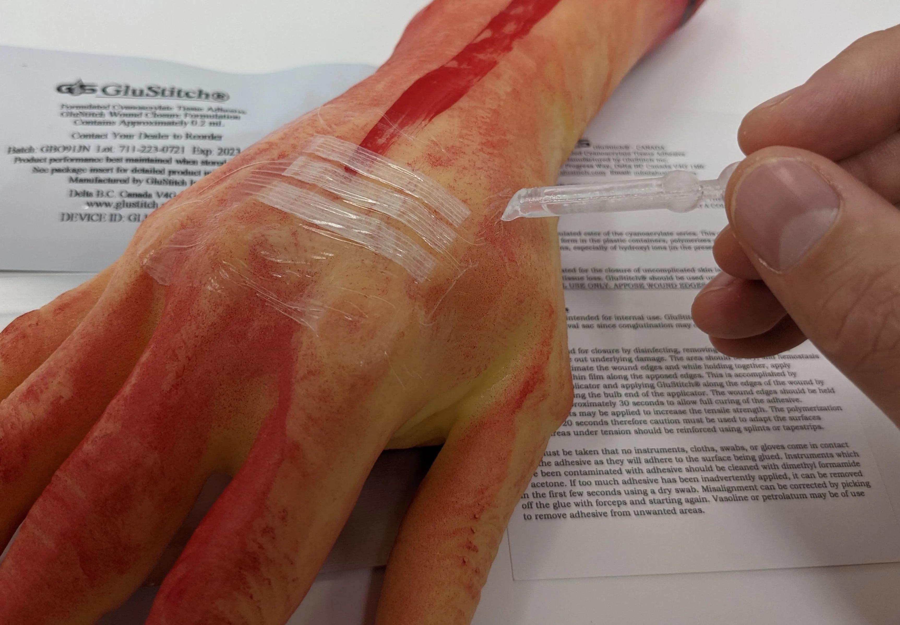 GluStitch Tissue Adhesive